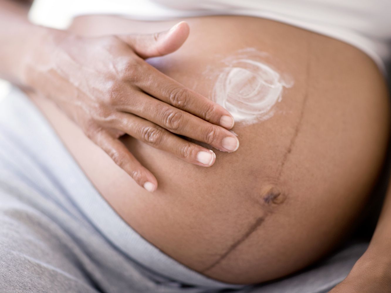 Πώς να απαλλαγείτε από τις ραγάδες της εγκυμοσύνης με φυσικό τρόπο